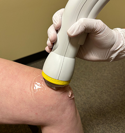 Chiropractic Kalamazoo MI SoftWave Knee