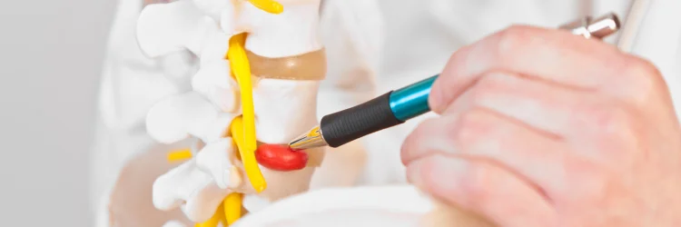 Kalamazoo MI Chiropractor Discusses Herniated Discs